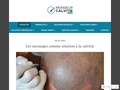 Site sur les chutes de cheveux: Monsieur Calvitie