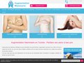 Chirurgie esthétique du sein en Tunisie: Augmentation mammaire