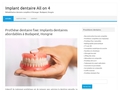 Implant Dentaire